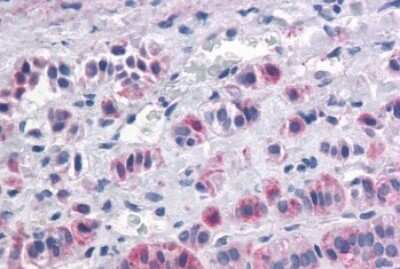 Immunohistochemistry-Paraffin: Orexin Receptor 1/2 Antibody [NBP3-14433]